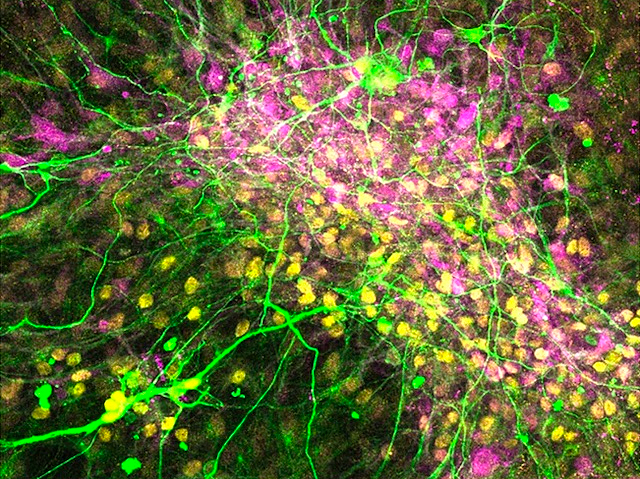 Fibres musculars envoltades per neurones motores