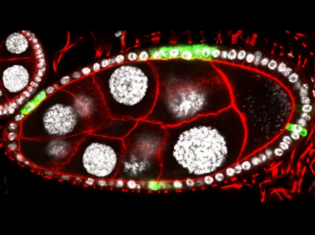 Cèl·lules epitelials de la mosca del vinagre amb un marcatge fluorescent diferencial