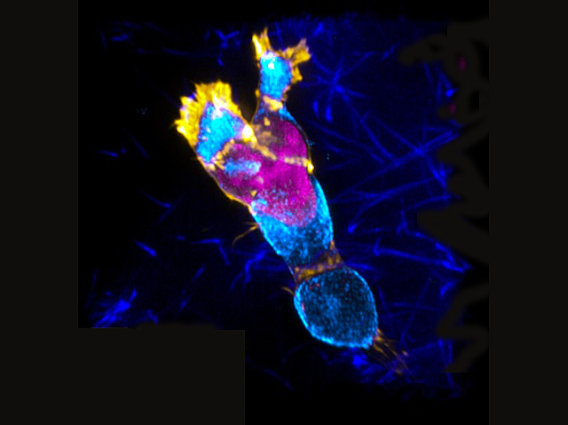 una cèl·lula amb una marca fluorescent per la perifèria