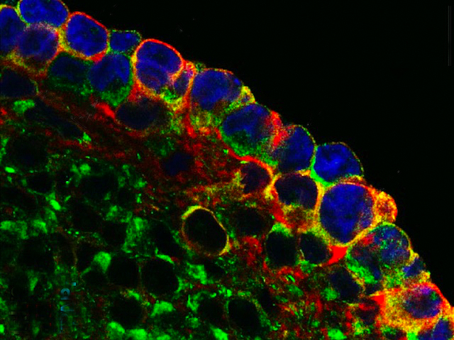 Un teixit al microscopi de fluorescència amb algunes cèl·lules plenes d'un marcador color roig i blau