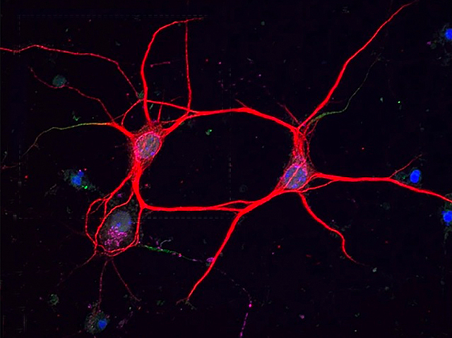dues neurones  tenyides en roig amb fluorescència formant un anell