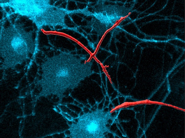 Neurones marcades amb fluorescència amb el primer tram de l'axó tenyit de roig