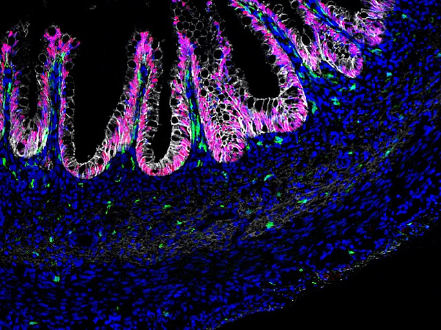 un segment de l'intestí tenyit amb diversos colors fluorescents