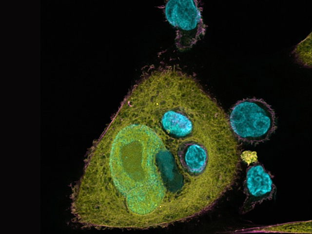 limfòcits T ressaltats en blau amb fluorescència entrant en una cèl·lula epitelial de major mida ressaltada en verd
