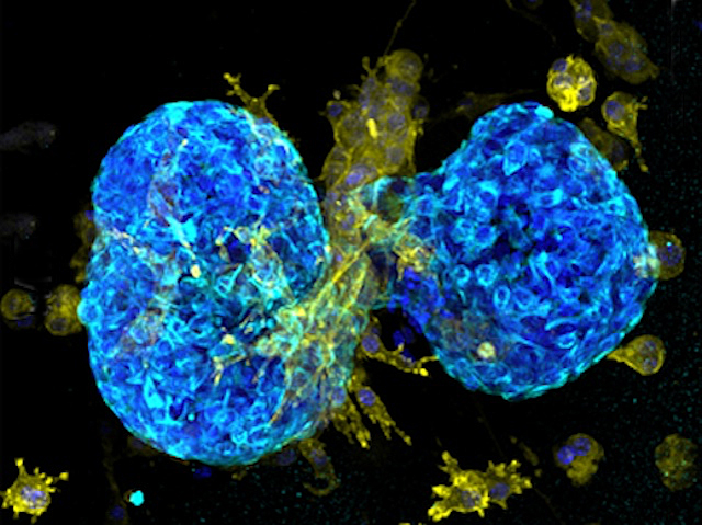 dos paquets de cèl·lules amb fluorescència blava i algunes cèl·lules amb fluorescència groga per fora