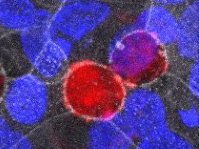 Cèl·lules d'un organoide  amb tinció roja i blava