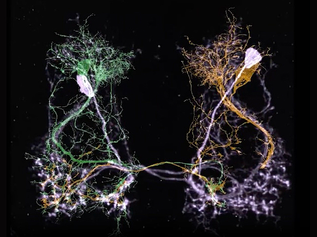un parell de neurones envoltades per una espècie de filaments