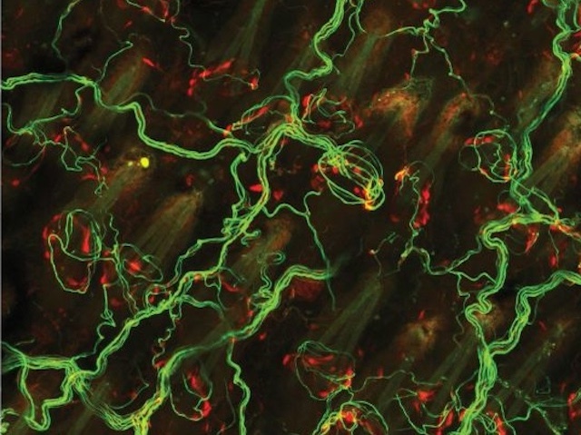 un filaments verds enmig d'uns cèl·lules