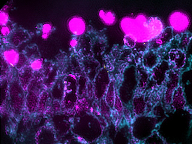 cèl·lules amb punts rosa molt brillants
