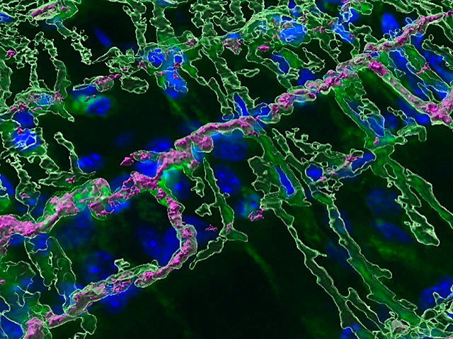 un punts blaus (virus) a l’interior de cèl·lules musculars