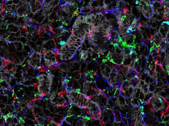 cèl·lules amb diferents colors junt a les glàndules salivals