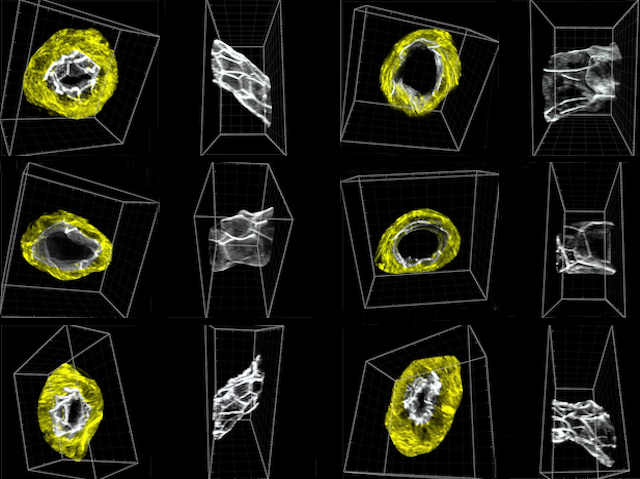 12 models tridimensionals d'un segment de l'urèter