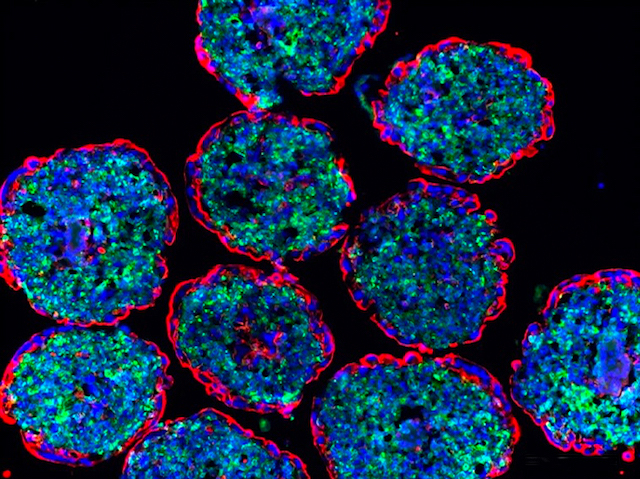 Estructures circulars (organoides) amb les cèl•lules externes de color roig i les de dins verd i blau