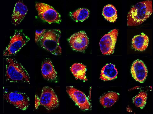 vint cèl·lules amb els nuclis blaus i marques de punts fluorescents