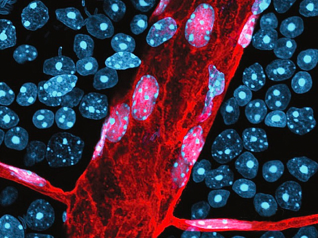 Teixit endotelial d'un vas sanguini en roig rodejat de cèl·lules blaves