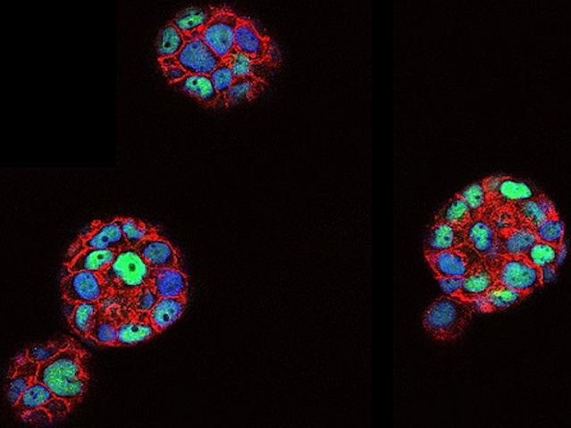 3 esferes fetes per cèl•lules amb nuclis verds o blaus
