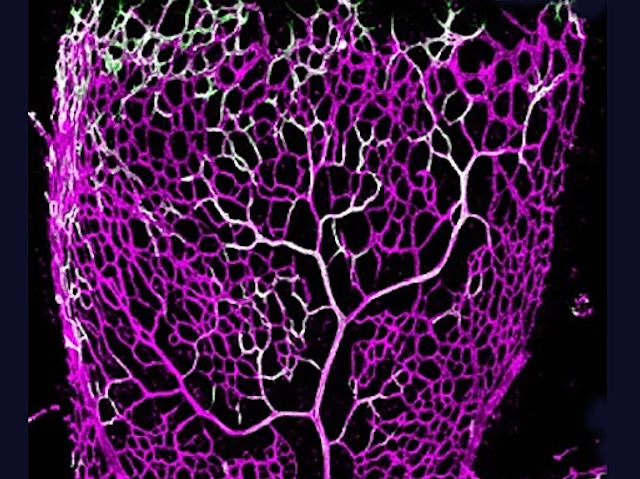 Una xarxa d'artèries de color morat, bifurcant-se com un riu gran