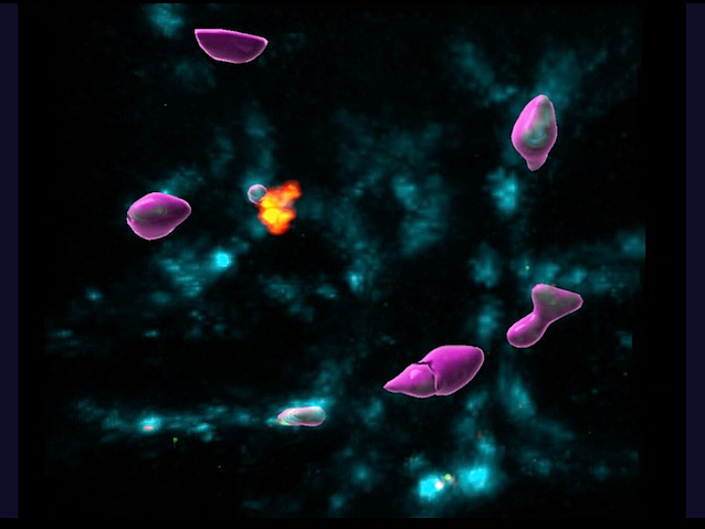 Unes taques blaves, difuminades, i unes cèl•lules púrpura ben definides