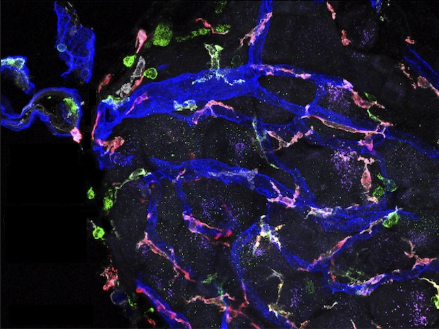 Una estructura esfèrica feta per cèl•lules amb diferents color, destacant vasos sanguinis allargats en blau