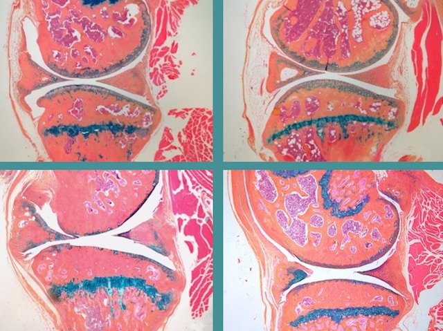 Quatre imatges diferents de seccions d'articulacions òssies