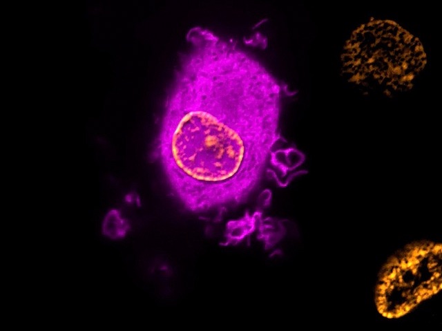 una cèl·lula  ovalada marcada amb fluorescència de color rosa  amb el nucli redó i taronja