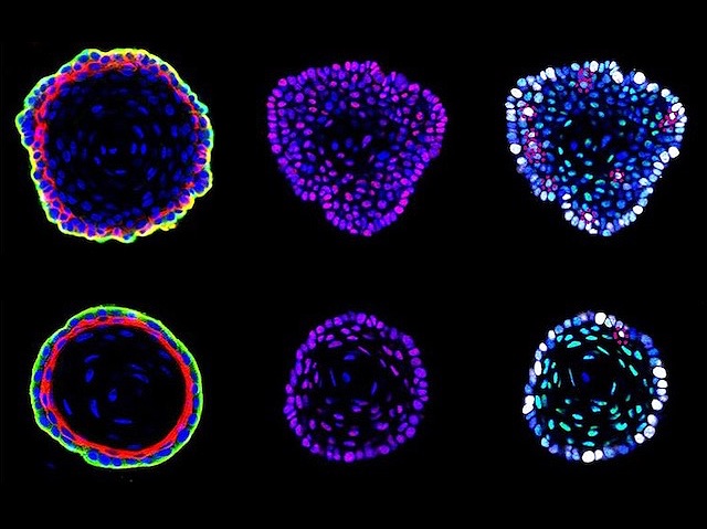 Una comparació de preparacions on s'observen diferents poblacions cel·lulars destacades per marcadors diferenciats per colors.