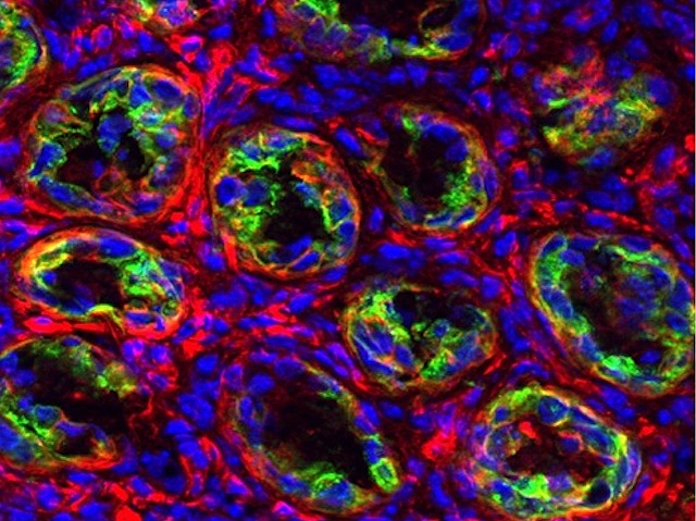 Tall longitudinal d'intestí prim on es veuen les criptes amb els nuclis cel·lulars blaus