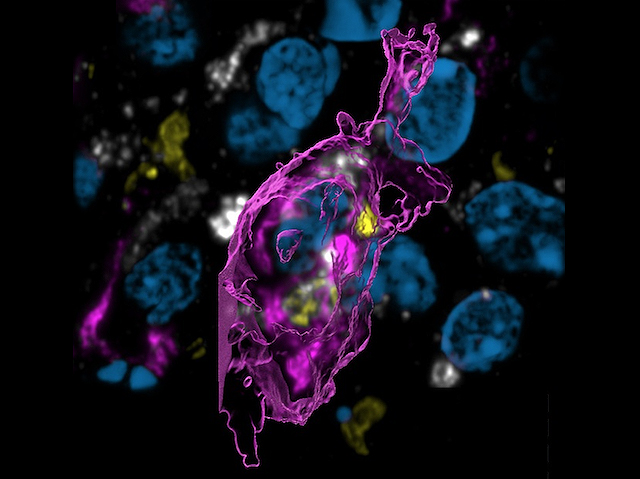 Imatge d'un macròfag a un cervell de ratolí afectat per glioblastoma