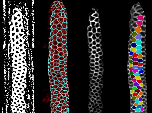 Quatre imatges de les cèl·lules germinals del cuc nematode en les quals es ressalten les cèl·lules de manera diferent i amb diferents colors en cadascuna