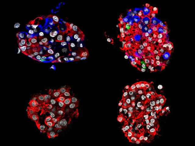 Diferents imatges de microscòpia de cèl·lules pancreàtiques en coloracions roges i blaves