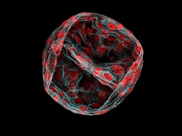 Forma esfèrica oberta per la part superior però delimitada per una línia en el centre. La forma principal està recoberta de petits òvals i pareix que continga una espècie de formes paregudes a vasos sanguinis en l'interior