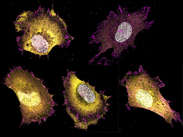 Imatge de les adhesions focals o complexos moleculars marcats amb fluorescència que permeten el moviment cel·lular