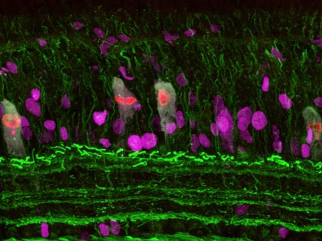 Neurones de la retina de pollastre