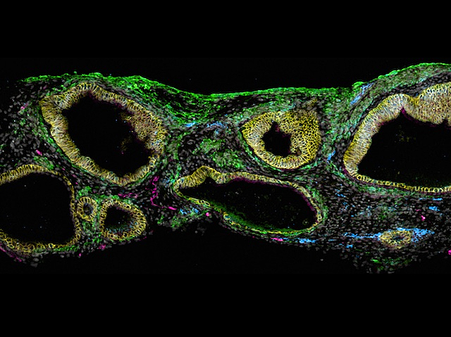 Imatge d'un organoide en microscòpia amb distintes parts tenyides de diferents colors; fúcsia, verd i blau