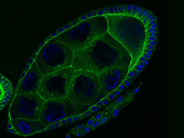 Cèl·lules epitelials de la mosca del vinagre amb el citoplasma resaltat en verd fluorescent i el nucli en blau.
