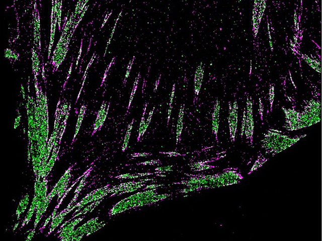 unions de color verd i proteïnes de color magenta al voltant 