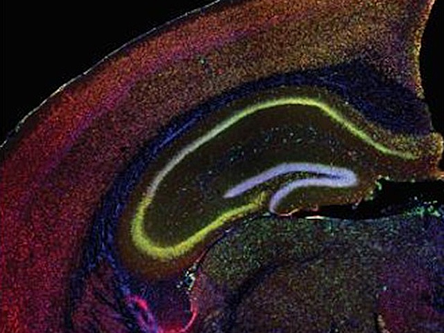Imatge d’una secció cerebral amb diverses capes acolorides que formen corbes lluminoses en tons grocs, morats, rojos i verds sobre fons fosc