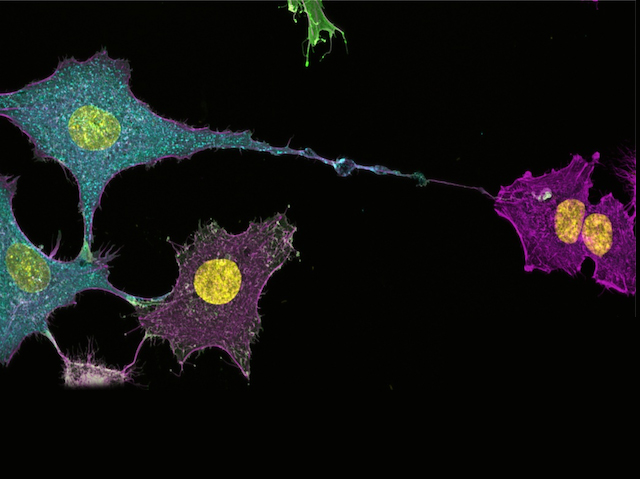Cèl·lules amb forma estrellada i filaments de colors vius, amb nuclis grocs sobre fons negre. Algunes estan connectades per un filament prim