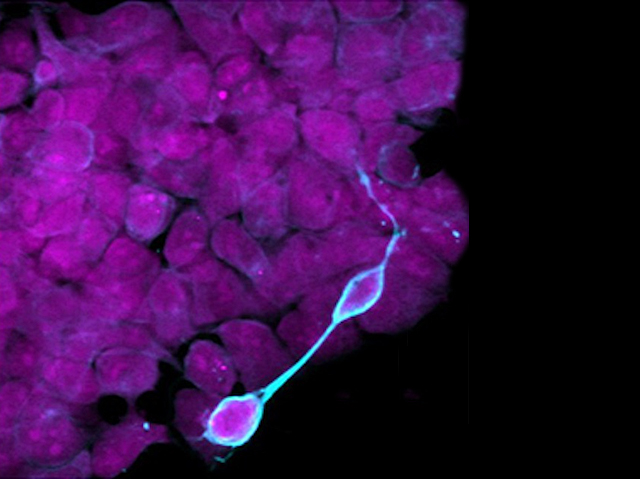 Fotografia al microscopi de cèl·lules mare embrionàries tenyides de morat i blau
