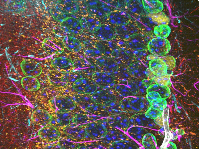 un conjunt de neurones verdes agrupades que tenen forma circular amb l'interior de color blau. També es veuen punts grocs i alguna línia rosa