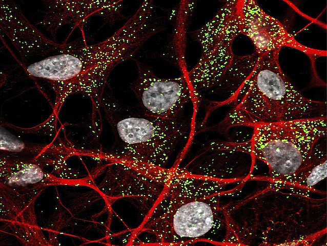 Peroxisomes fluorescents verds a les cèl·lules