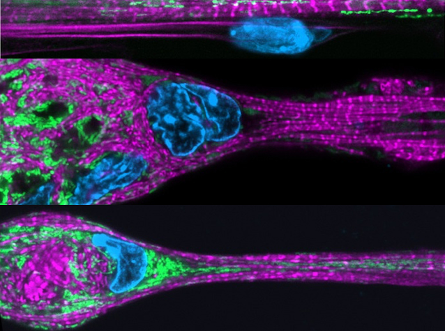 Connexió de mitocondris i miofibril·les mitjançant els microtúbuls