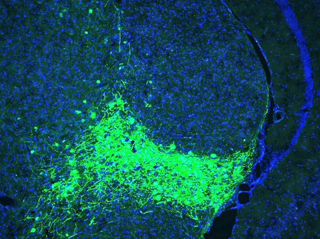 Tàlem amb neurones marcades en verd