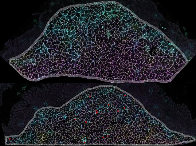 Models d'intestí sense (a dalt) o amb (a baix) diòxid de titani