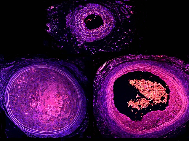 Artèria caròtida de ratolins sans, mutants i tractats
