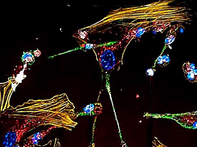 Macròfags induïnt la mort cel·lular