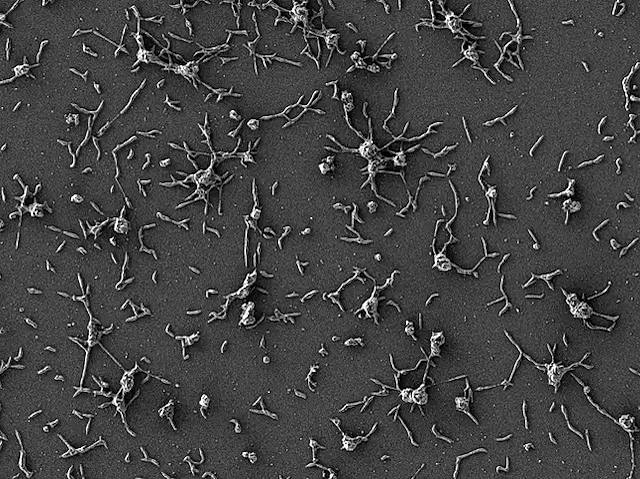 Mycoplasma pneumoniae vist amb microscopi electrònic de rastreig