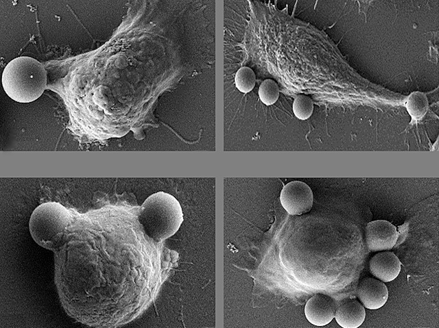 A la dreta, macròfags amb menys proteïna sintaxina-2 fagocitant, i a l'esquerra macròfags amb quantitats normals de sintaxina-2 facogitant. Imatges amb microscòpia electrònica, en blanc i negre.