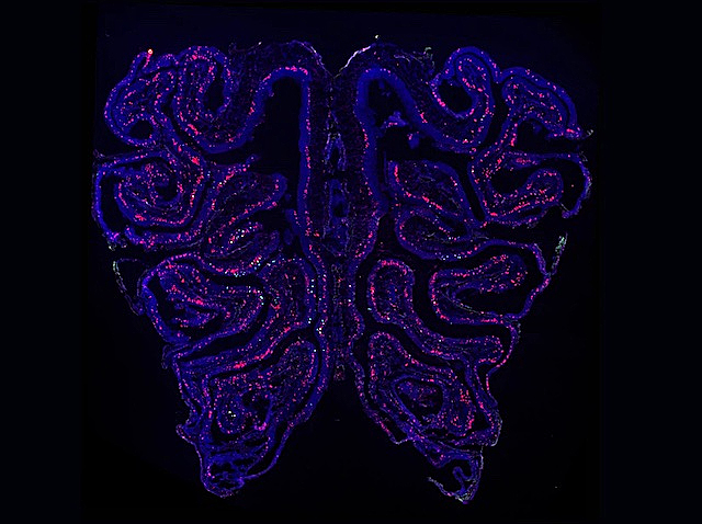 Neurones proliferants de color rosa i epiteli olfactori de color blau