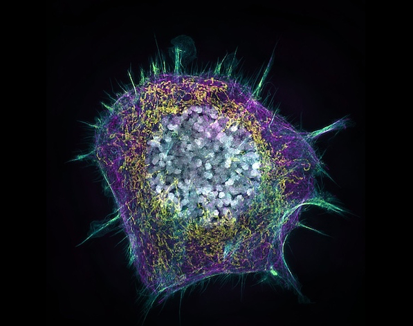 Forma ameboide amb prolongacions puntiagudes i cercle carregat de petites esferes